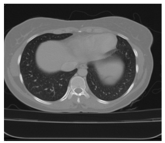 abdominalct.png