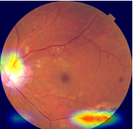 retinaheatmap.png