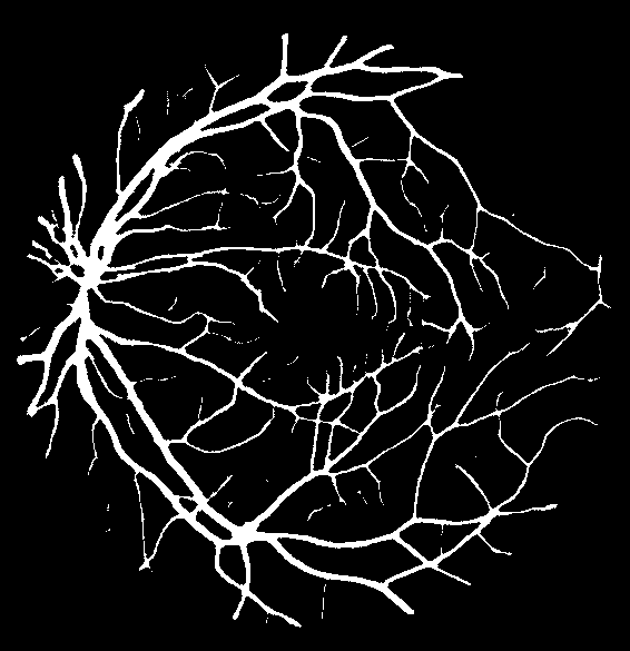 segmentationretina.png